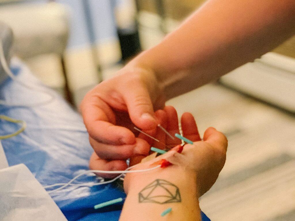 Peregrine Acupuncture